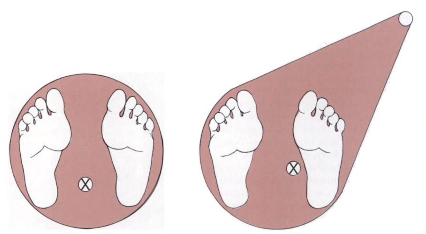 Effects of holding a cane on base of support deviating mean from center of pressure laterally towards cane position. Image From: (Shumway-cook, 2004).