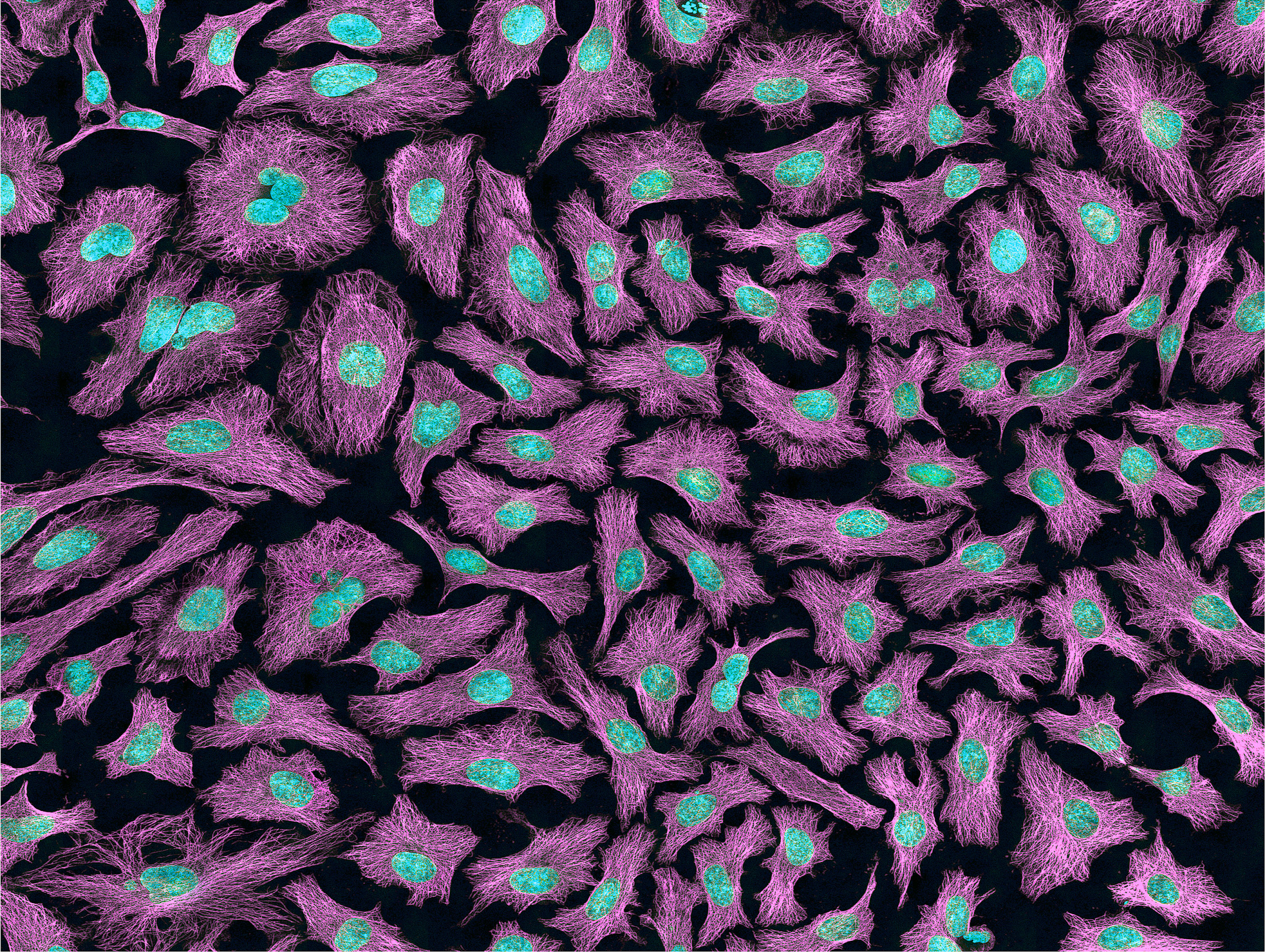 Microscope image of irregularly shaped cells with bright nuclei.