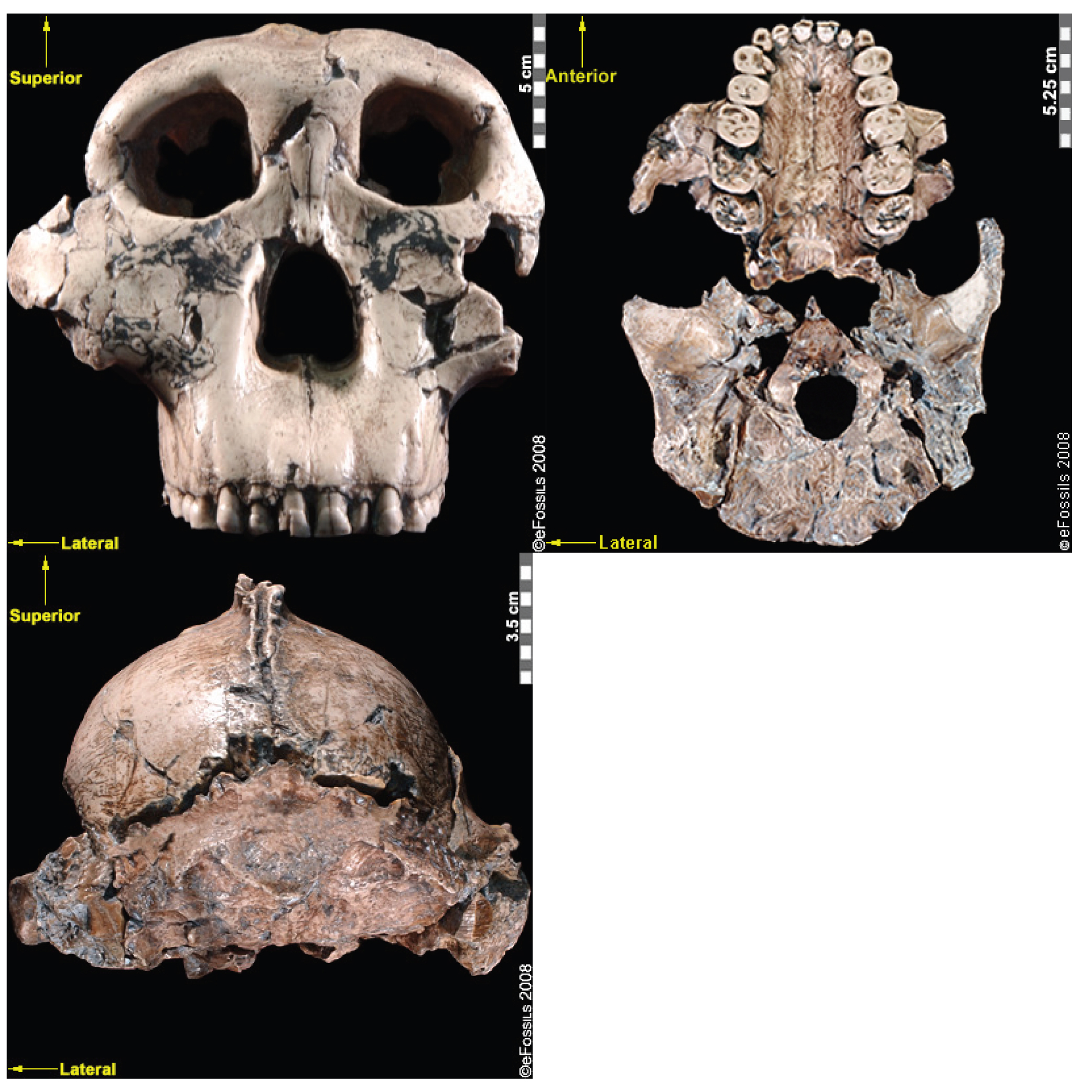 Three views of an ancient skull are shown on a black background.