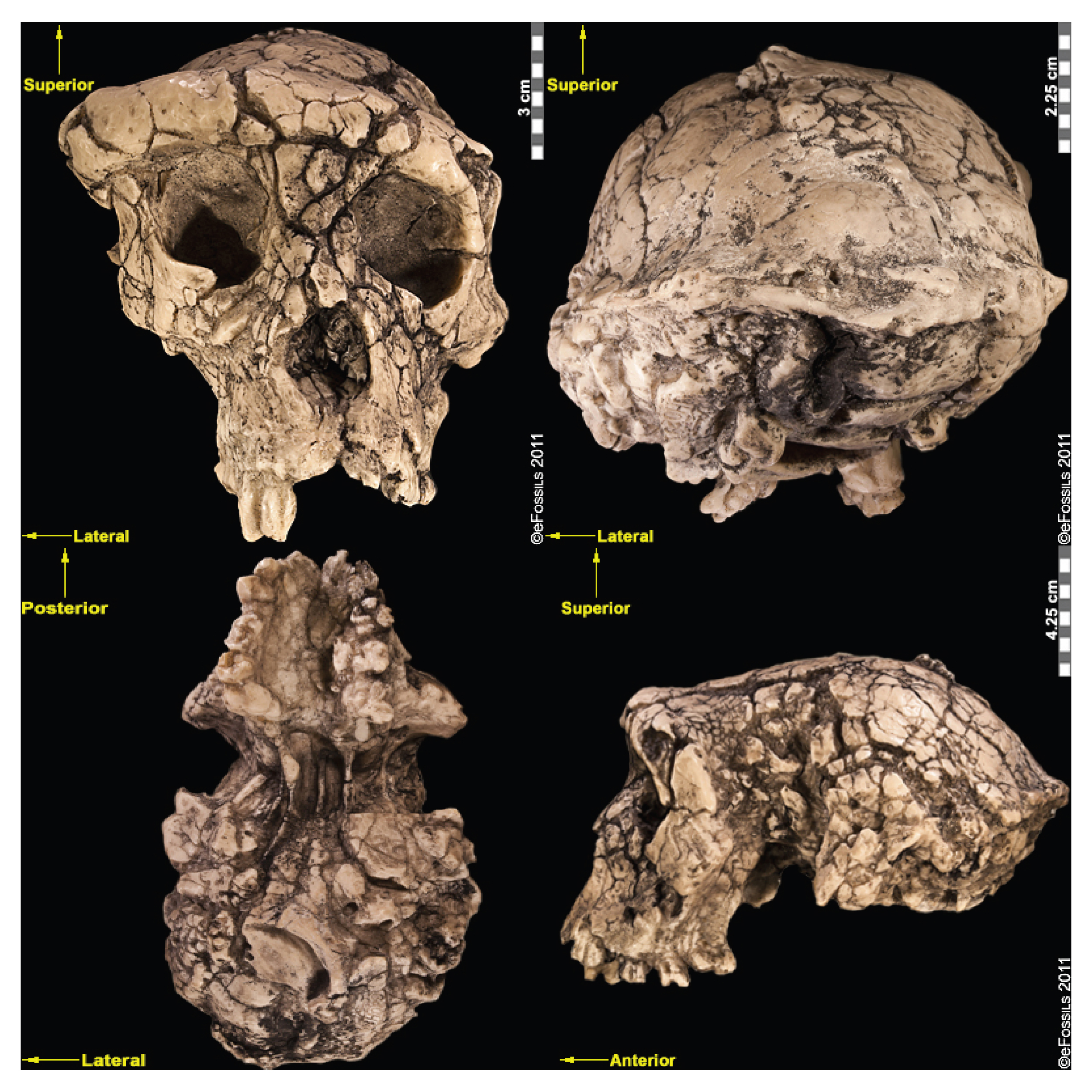 Four views of a beige-colored skull are seen against a black background.