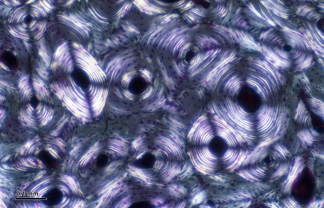 Microscope image showing clustered osteons. Each has many rings and a dark center.