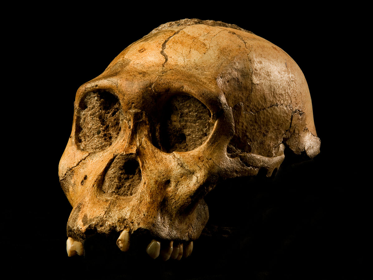 A beige-colored skull with no mandible on a black background has some missing teeth.