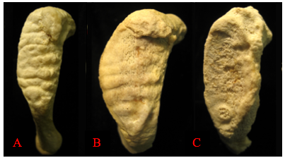 Surfaces of three pubic symphyses: billowy (A) to more flat (B) to rough (C).