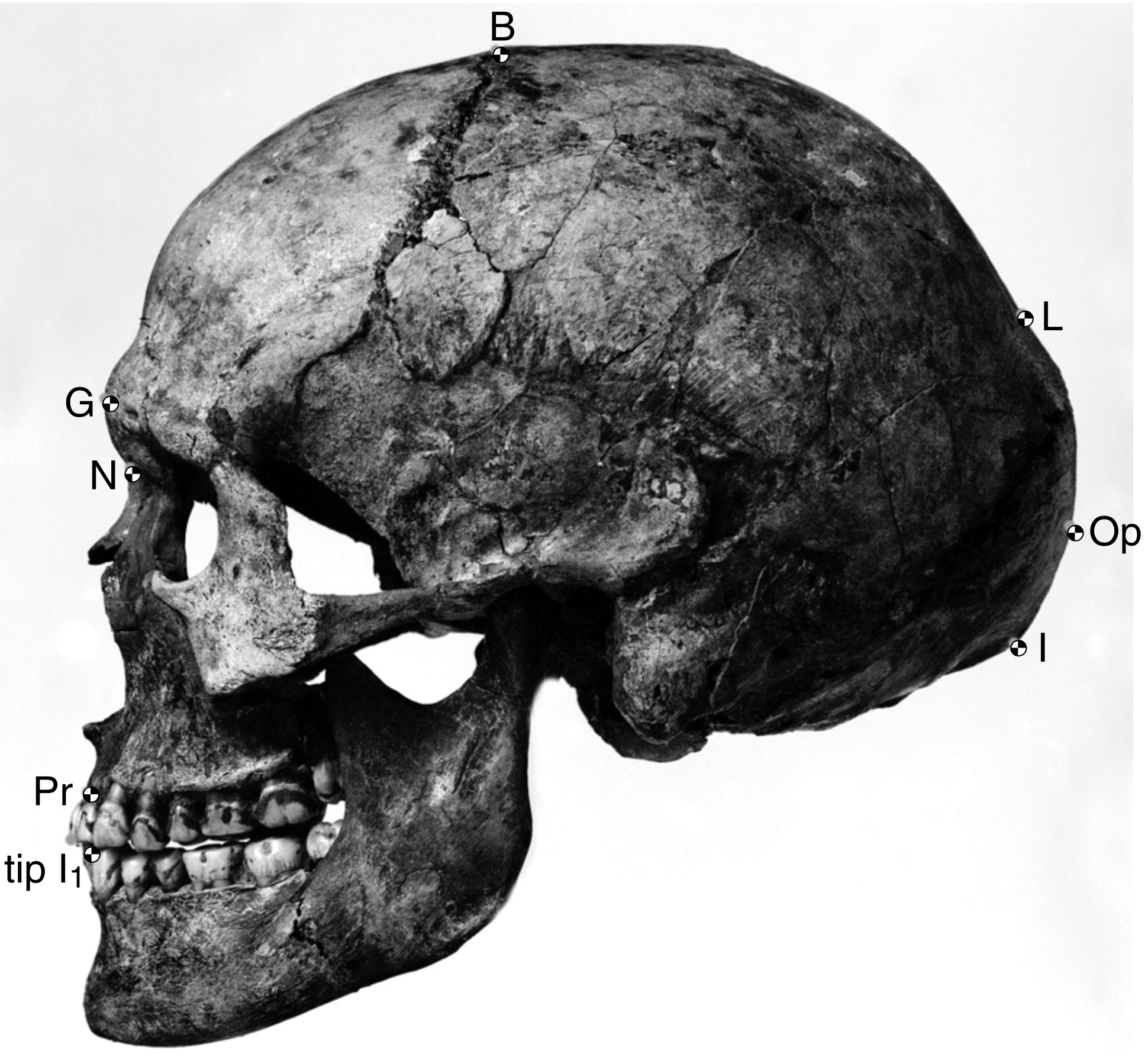 Black-and-white photograph of a human skull with labeled cranial landmarks.