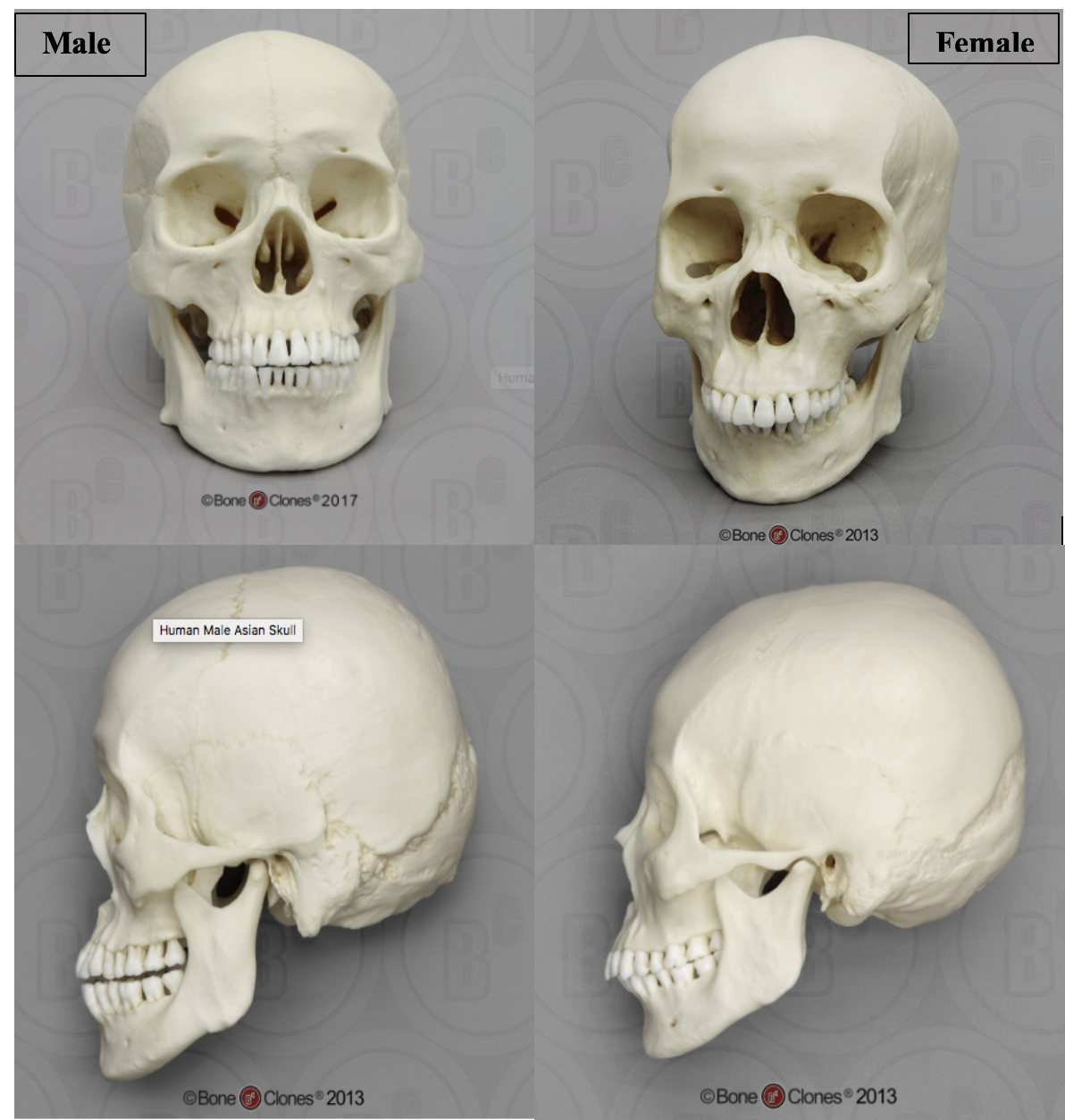 Front and side images of a male (left) and female (right) cranium.