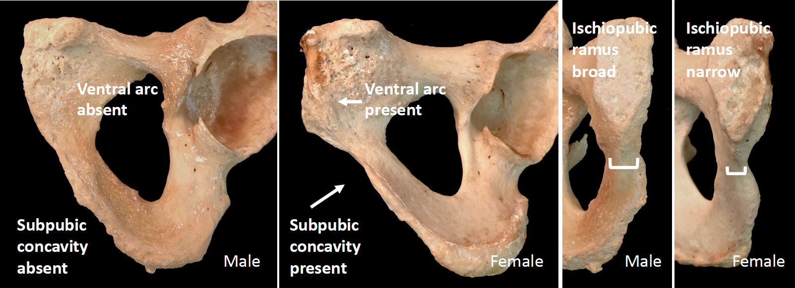 Male and female os coxae (anterior portions).