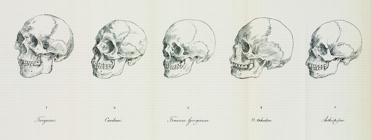 Historic drawing of five skulls.
