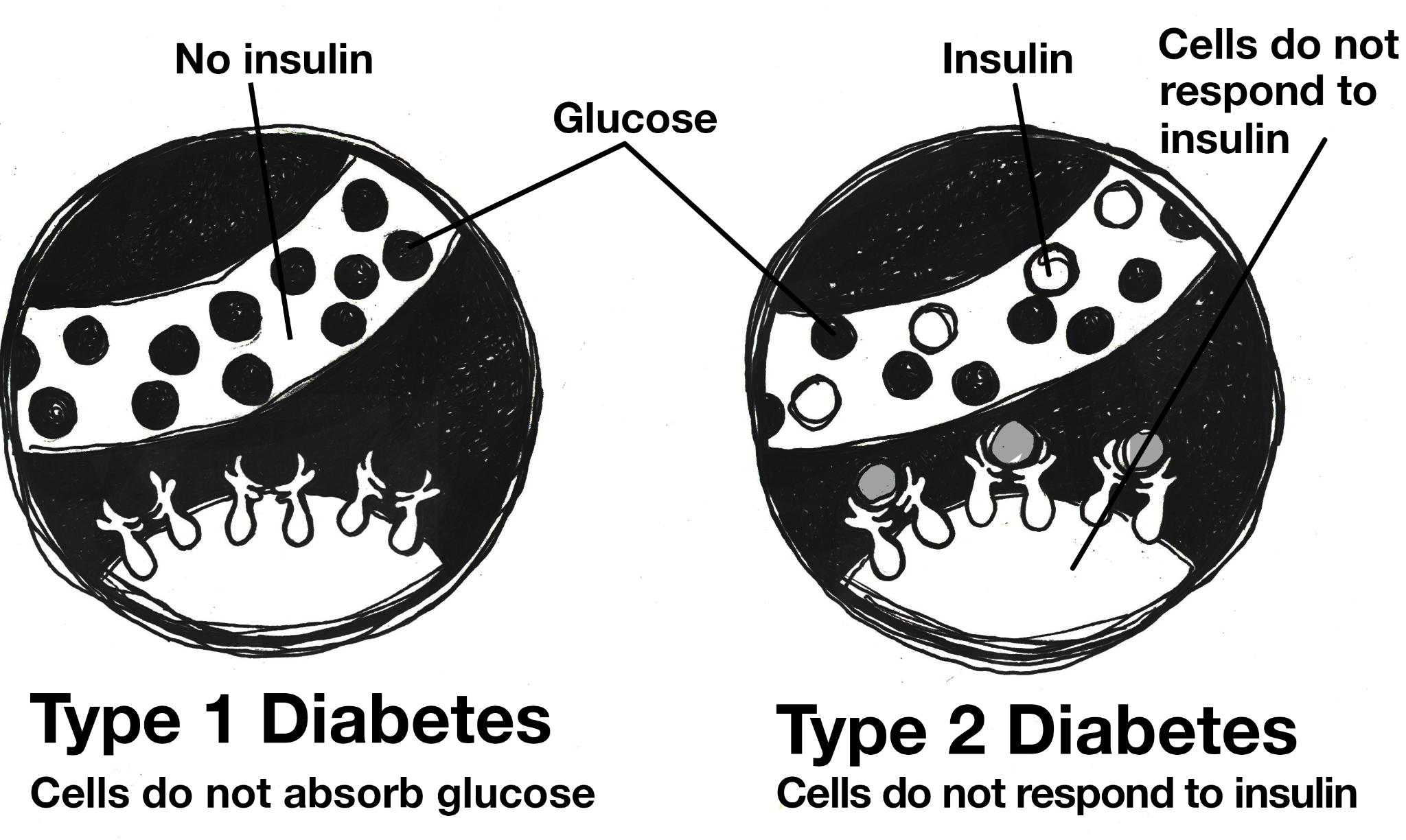 Type 1 cells and Type 2 cells and their response to insulin.