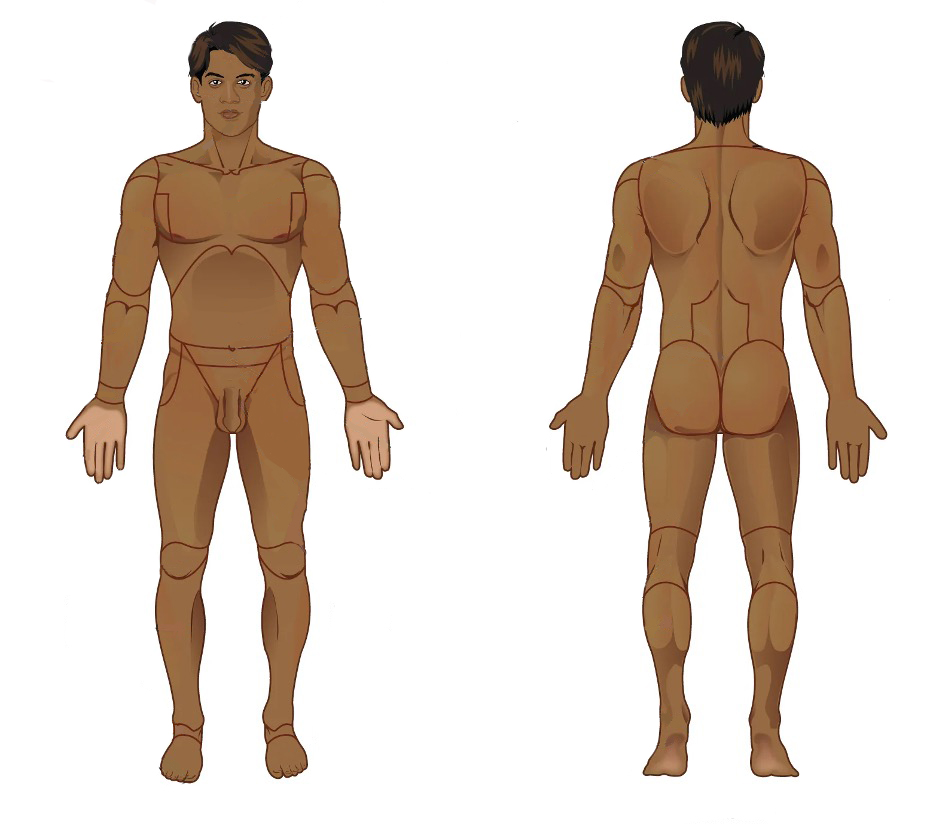 Front and back views with lines showing body regions.